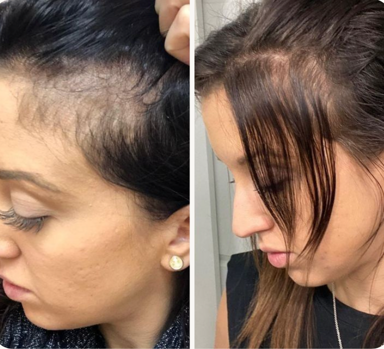 Lotion Booster – Anti-chute & pousse accélérée