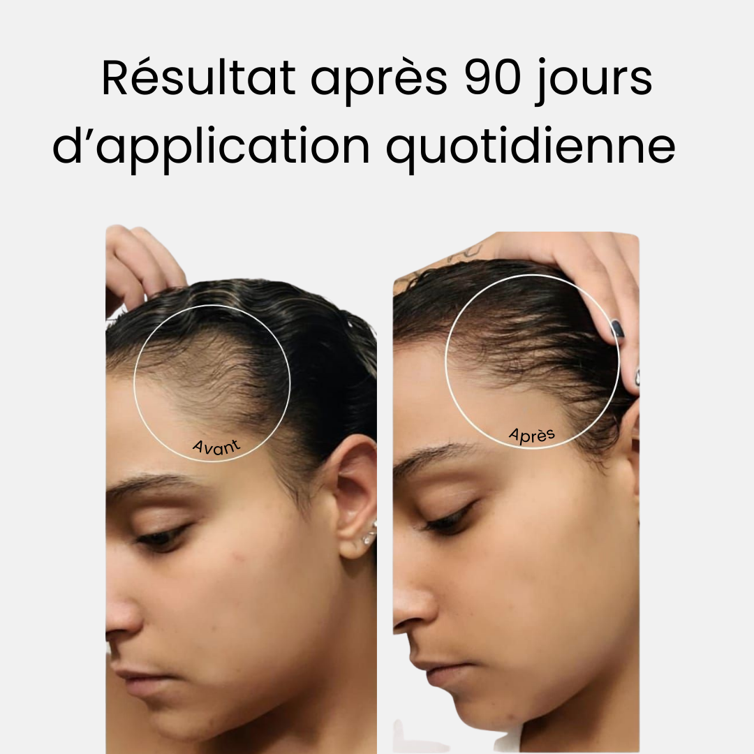 Lotion Booster – Anti-chute & pousse accélérée